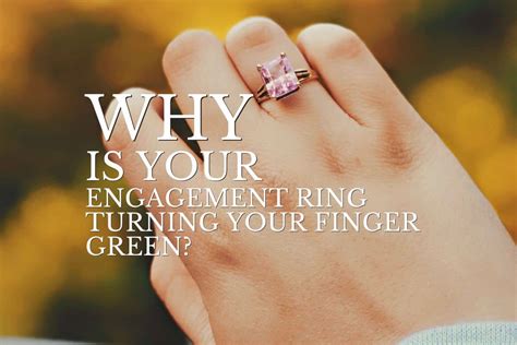 what causes a ring to turn your finger green